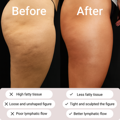 CelluSmooche Legging - Redefine your silhouette effortlessly